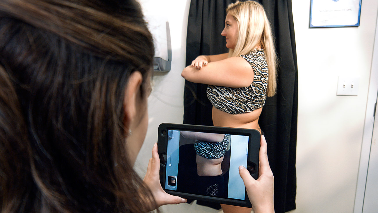 CoolSculpting Treatment Photography Photo #5