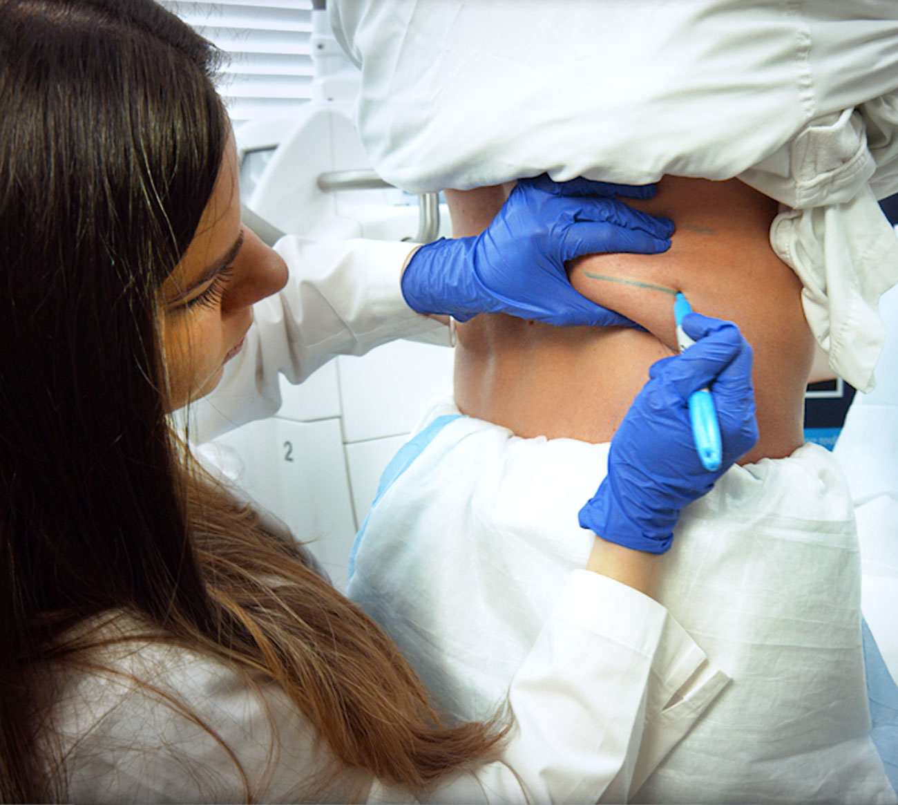 CoolSculpting Treatment Photography for Bowes Dermatology by Riverchase in Miami. Photo #3.