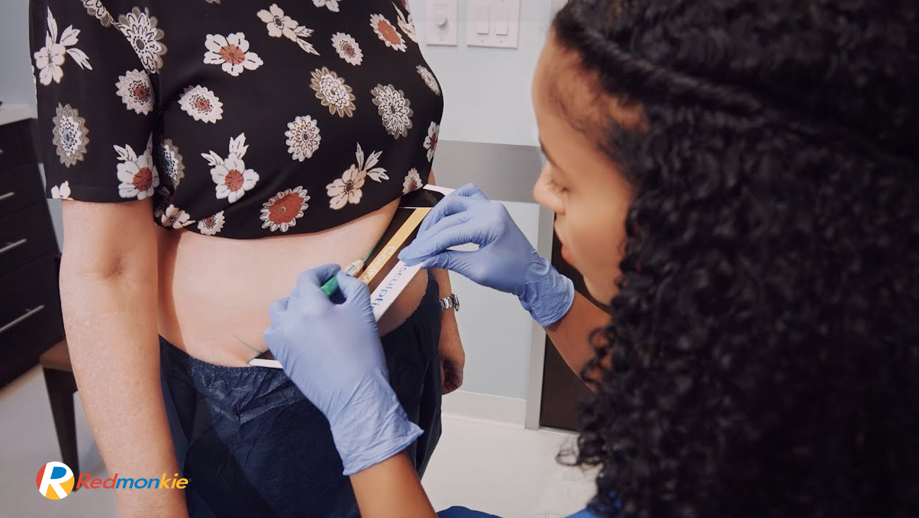 Our most recent produced CoolSculpting educational video by CoolSculpting Team Leader Manuela Perez, at Sunset Dermatology in South Miami, has been published.